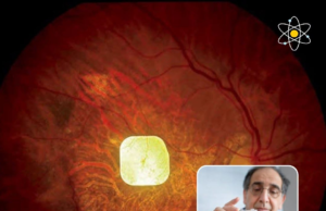 PRIMA System: Teknologi Baru untuk Memulihkan Sel yang Berguna