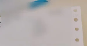 Seorang rakyat Malaysia yang bersyukur mendakwa telah membayar hanya RM41 untuk pembedahan batu karang di hospital kerajaan.