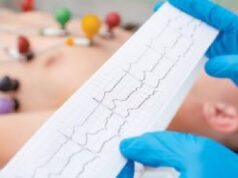 “Tergamam Aku” – Seorang wanita berkongsi pengalamannya ketika menjalani pemeriksaan ECG, dan terkejut apabila diminta untuk membuka pakaian dalam. Ia adalah pengalaman yang tidak diduga dan menimbulkan rasa kekok, tetapi dia akhirnya memahami kepentingan prosedur tersebut untuk keselamatan kesihatannya.