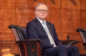 PM Australia mohon maaf atas komen terhadap Kylie Minogue yang dianggap tidak sopan
