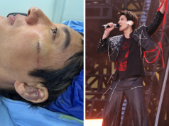 Wang Leehom Terus Nyanyi Walaupun Jatuh Teruk di Atas Pentas, 39 Jahitan Diperlukan (VIDEO)